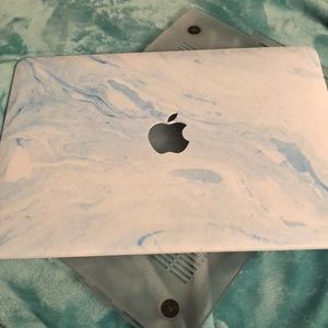 Blue & White Marbled 13” MacBook Air Laptop Case